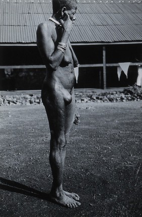 Uganda: a Lango woman with a growth in her groin area: side view. Photograph by Cecil John Hackett, ca. 1937.