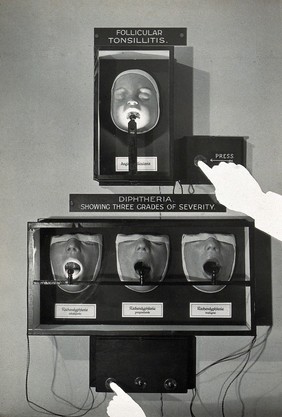 The Wellcome Building, Euston Road, London: demonstration of an interactive display in the Wellcome Museum of Medical Science on the symptoms of follicular tonsillitis and diphtheria. Photograph.