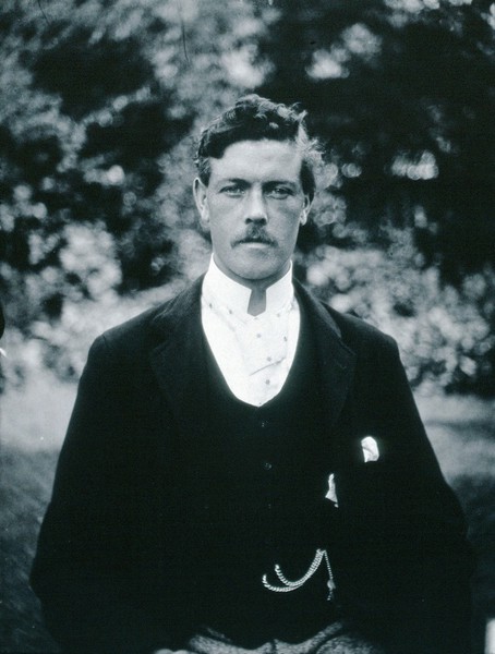 Gloucester smallpox epidemic, 1896: Edwin Davis, a smallpox patient. Photograph by H.C.F., 1896.