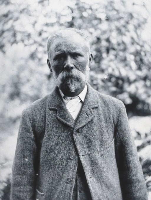 Gloucester smallpox epidemic, 1896: George Steel, a smallpox patient. Photograph by H.C.F., 1896.