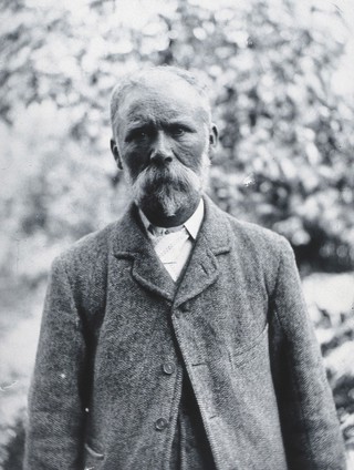 Gloucester smallpox epidemic, 1896: George Steel, a smallpox patient. Photograph by H.C.F., 1896.