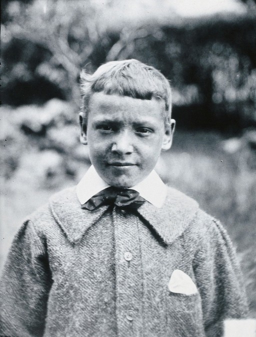Gloucester smallpox epidemic, 1896: J.R. Evans, aged 10 years, a smallpox patient, after recovery. Photograph by H.C.F., 1896.