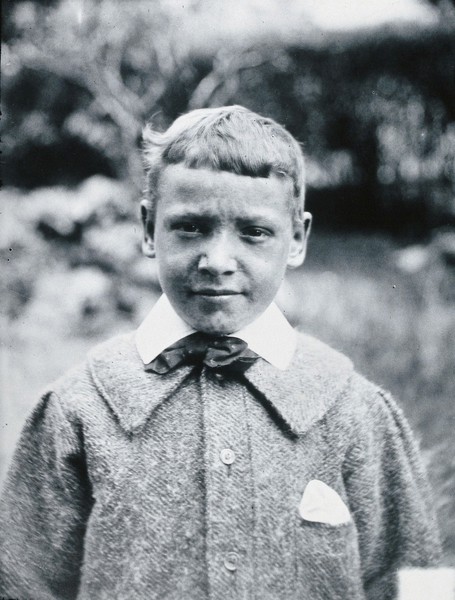 Gloucester smallpox epidemic, 1896: J.R. Evans, aged 10 years, a smallpox patient, after recovery. Photograph by H.C.F., 1896.