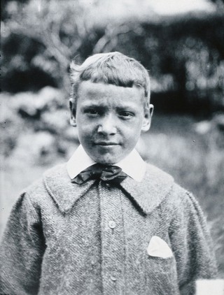 Gloucester smallpox epidemic, 1896: J.R. Evans, aged 10 years, a smallpox patient, after recovery. Photograph by H.C.F., 1896.