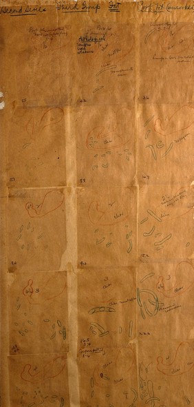 Tracings showing the passage of food (uncooked pork fat) through the small intestine; top half. Chart by W.B. Cannon, 1901.