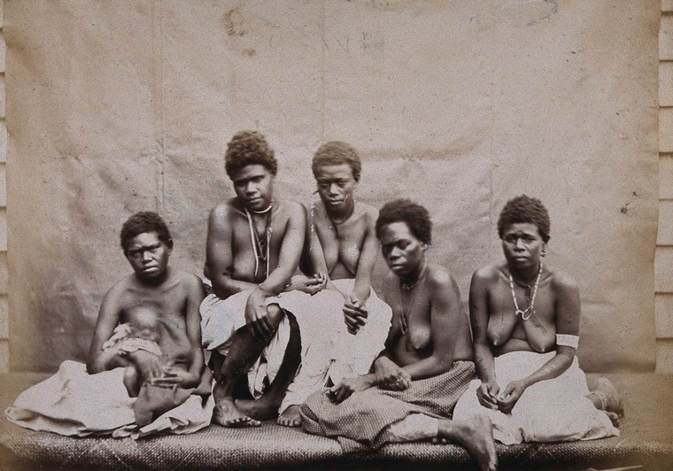 Polynesia: Polynesian women with bare breasts, seated: group portrait.  Photograph attributed to André-Alexandre Jollet.