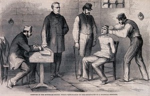 view Torture in a Sicilian prison in Monreale: the prisoner has a tourniquet applied to his forehead. Wood engraving.