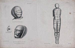 view The uncovered head of a mummy: showing the head with the outer covering removed and the head with a pledget of tow in the mouth. Lithograph by J. Basire after George Scharf, 1852.