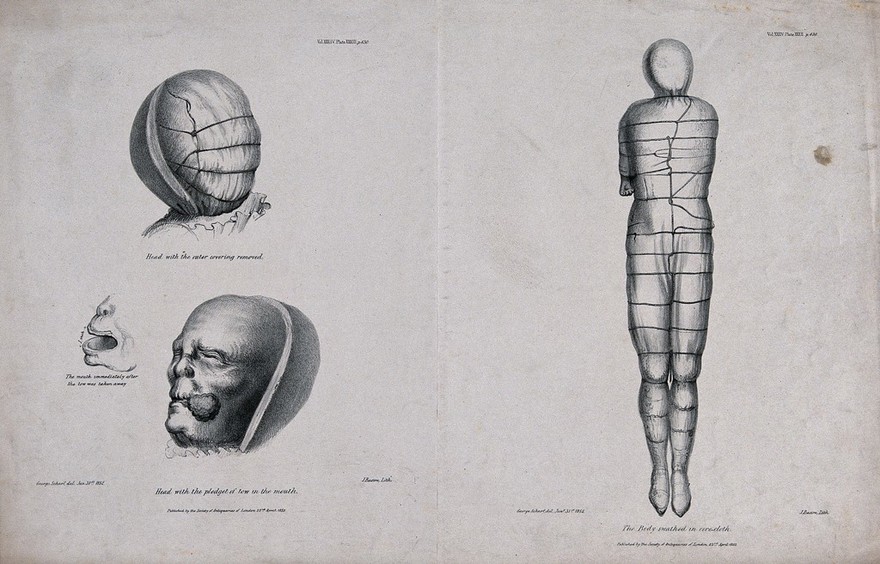 The uncovered head of a mummy: showing the head with the outer covering removed and the head with a pledget of tow in the mouth. Lithograph by J. Basire after George Scharf, 1852.