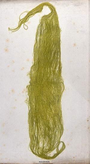 view A mass of filamentous green algae, possibly a Spirogyra species. Colour nature print by A. Auer, c. 1853.