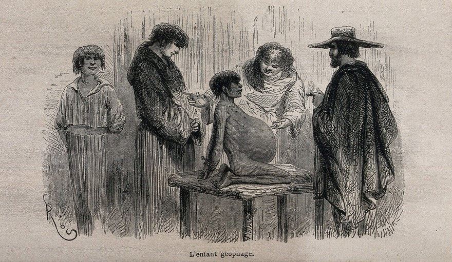 Friars at Pevas (Pebas, Pehuas), Peru, showing to Paul Marcoy a five-year old girl with a desire to eat earth (geophagia). Wood engraving by E. Riou, 186-.