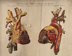 view Two lateral views of the human heart. Coloured engraving by G. Kirtland, 1806.