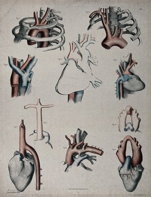 view The circulatory system: dissections showing the aorta, arteries, veins and heart, with arteries and veins indicated in red and blue. Coloured lithograph by J. Maclise, 1841/1844.