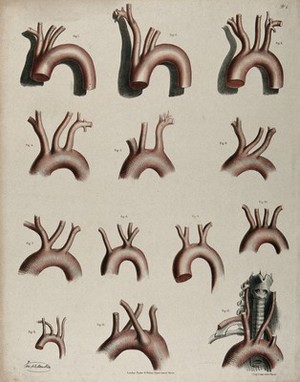 view The circulatory system: dissections of the aortic arch (?), thirteen figures. Coloured lithograph by J. Maclise, 1841/1844.