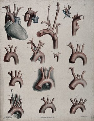 view The circulatory system: dissections showing the aorta, arteries, veins and heart, with arteries and veins indicated in red and blue. Coloured lithograph by J. Maclise, 1841/1844.