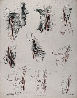 view The circulatory system: dissections of the neck and jaw of a man, with arteries and blood vessels indicated in red. Coloured lithograph by J. Maclise, 1841/1844.