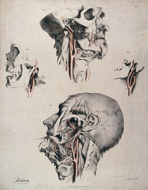 view The circulatory system: four dissections of the male face, neck and skull, with arteries and blood vessels in red. Coloured lithograph by J. Maclise, 1841/1844.