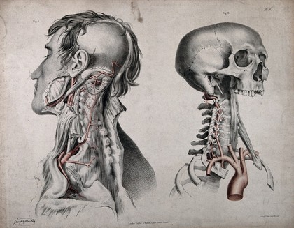 The circulatory system: two dissections of the neck, jaw and skull of a man, with aortic arch (?), arteries and blood vessels indicated in red. Coloured lithograph by J. Maclise, 1841/1844.