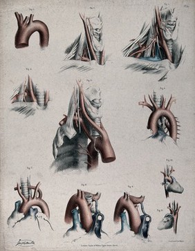 The circulatory system: dissections showing the aortic arch (?), arteries and veins of the neck, with arteries and veins indicated in red and blue. Coloured lithograph by J. Maclise, 1841/1844.