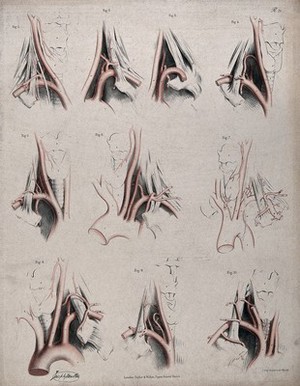 view The circulatory system: dissections showing the aortic arch (?), arteries and blood vessels of the neck, with arteries and blood vessels indicated in red. Coloured lithograph by J. Maclise, 1841/1844.