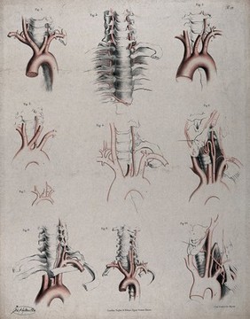 The circulatory system: dissections showing the aortic arch (?), arteries and blood vessels in relation to the spine and ribs, with arteries and blood vessels indicated in red. Coloured lithograph by J. Maclise, 1841/1844.