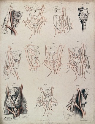 The larynx and other organs in the neck. Lithograph by J. Maclise, 1841/1844.