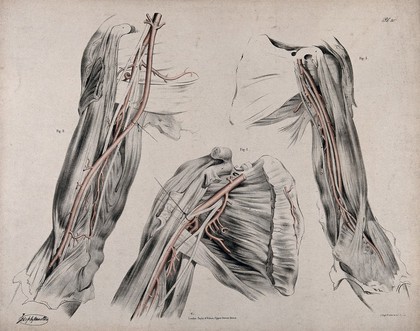 The circulatory system: dissections of the upper arm and the shoulder, with arteries and blood vessels indicated in red. Coloured lithograph by J. Maclise, 1841/1844.