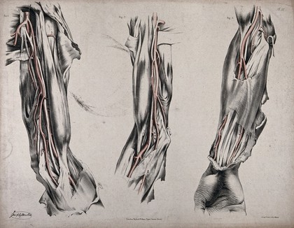 The circulatory system: three dissections of the arm, with arteries and blood vessels indicated in red. Coloured lithograph by J. Maclise, 1841/1844.