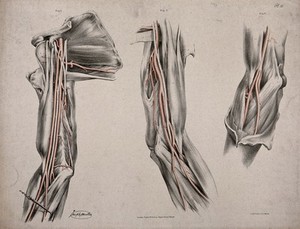 view The circulatory system: three dissections of the arm, shoulder and elbow, with arteries and blood vessels indicated in red. Coloured lithograph by J. Maclise, 1841/1844.