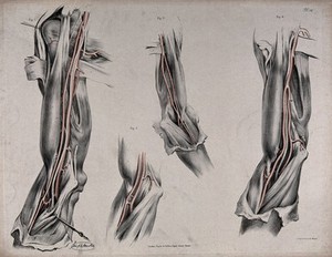 view The circulatory system: dissections of the arm, shoulder and elbow, with arteries and blood vessels indicated in red. Coloured lithograph by J. Maclise, 1841/1844.
