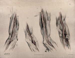 view The circulatory system: dissections of the arm and elbow, with arteries and blood vessels indicated in red. Coloured lithograph by J. Maclise, 1841/1844.