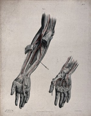 view The circulatory system: two dissections of the arm and the hand, with arteries and blood vessels indicated in red. Coloured lithograph by J. Maclise, 1841/1844.