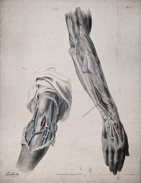 The circulatory system: two dissections of the arm and the hand, with arteries, blood vessels and veins indicated in red and blue. Coloured lithograph by J. Maclise, 1841/1844.