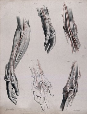 The circulatory system: dissections of the hand, elbow and arm, with arteries and blood vessels indicated in red. Coloured lithograph by J. Maclise, 1841/1844.