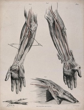 The circulatory system: three dissections of the hand and arm, with arteries and blood vessels indicated in red and surgical instruments shown beneath. Coloured lithograph by J. Maclise, 1841/1844.