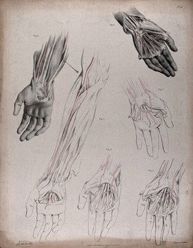 The circulatory system: dissections of the arm and hand, with the arteries indicated in red. Coloured lithograph by J. Maclise, 1841/1844.