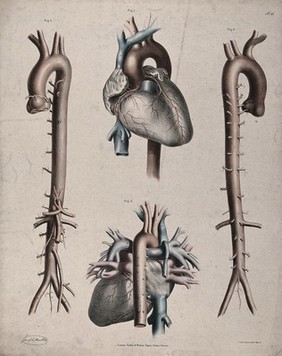 The circulatory system: dissection showing the heart and aorta, with arteries and veins indicated in red and blue. Coloured lithograph by J. Maclise, 1841/1844.