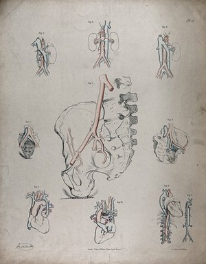 view The circulatory system: diagrams showing the heart, kidneys and pelvic bones, with the arteries and veins indicated in red and blue. Coloured lithograph by J. Maclise, 1841/1844.