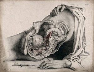 view The circulatory system: dissection of the abdomen and pelvic region of a man, side view, showing the intestines and bladder, with the arteries indicated in red. A surgical instrument is shown below. Coloured lithograph by J. Maclise, 1841/1844.