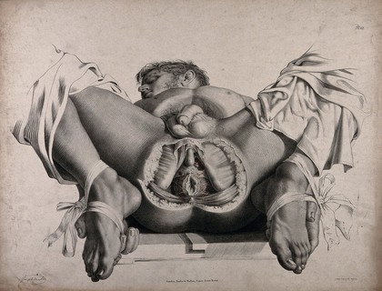 The circulatory system: dissection of the anal and genital area of a man, with the arteries (?) indicated in red. Coloured lithograph by J. Maclise, 1841/1844.