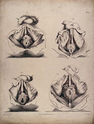 view The circulatory system: dissections of the male reproductive system and anal area, with the arteries (?) indicated in red. Coloured lithograph by J. Maclise, 1841/1844.
