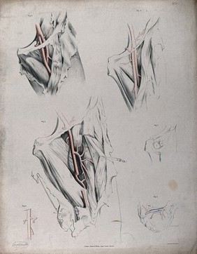 The circulatory system: dissections of the groin and thigh of a man (?), with the arteries indicated in red. Coloured lithograph by J. Maclise, 1841/1844.