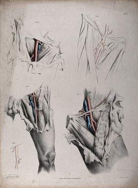 The circulatory system: dissections of the groin and thigh of a man, with the arteries and veins indicated in red and blue. Coloured lithograph by J. Maclise, 1841/1844.