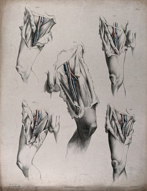view The circulatory system: dissections of the groin and upper thighs of a man, with the arteries and veins indicated in red and blue. Coloured lithograph by J. Maclise, 1841/1844.