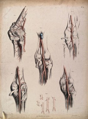 The circulatory system: dissections of the knee joint, with arteries and veins indicated in red and blue. Coloured lithograph by J. Maclise, 1841/1844.