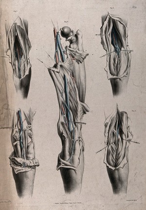 view The circulatory system: dissections of the leg, with arteries and veins indicated in red and blue. Coloured lithograph by J. Maclise, 1841/1844.