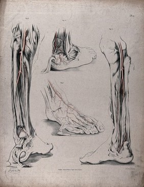 The circulatory system: dissections of the foot, lower leg and ankle, with arteries (?) indicated in red. Coloured lithograph by J. Maclise, 1841/1844.