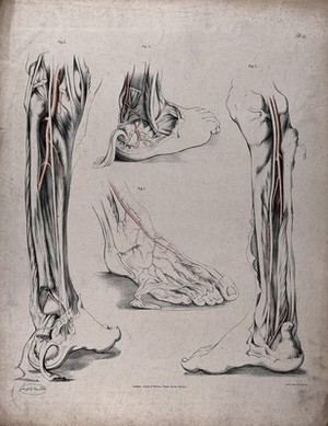 view The circulatory system: dissections of the foot, lower leg and ankle, with arteries (?) indicated in red. Coloured lithograph by J. Maclise, 1841/1844.