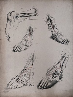 The circulatory system: dissections of the foot and ankle, with arteries (?) indicated in red. Coloured lithograph by J. Maclise, 1841/1844.