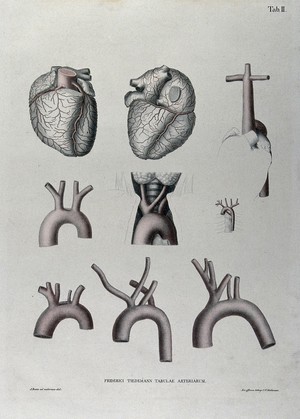 view The heart, arteries of the neck and the aortic arch (?): nine figures, with arteries indicated in red. Coloured lithograph by J. Roux, 1822.